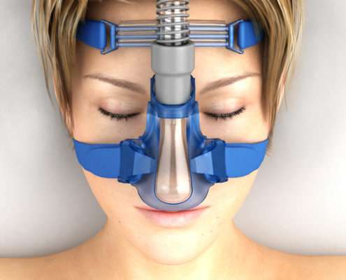 Nasal Mask